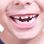 Milk teeth are the foundation of childrens future negligence can prove costly Dr. Chandan Kumar